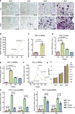 Aging Relevant Metabolite Itaconate Inhibits Inflammatory Bone Loss